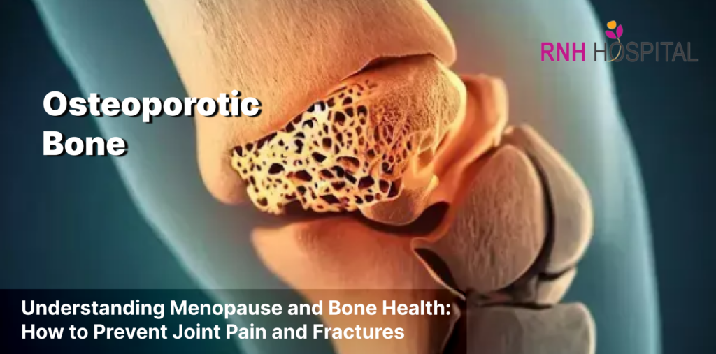 Understanding menopause and bone health