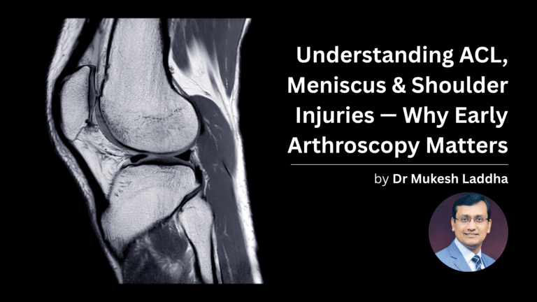 Understanding ACL, Meniscus & Shoulder Injuries — Why Early Arthroscopy Matters