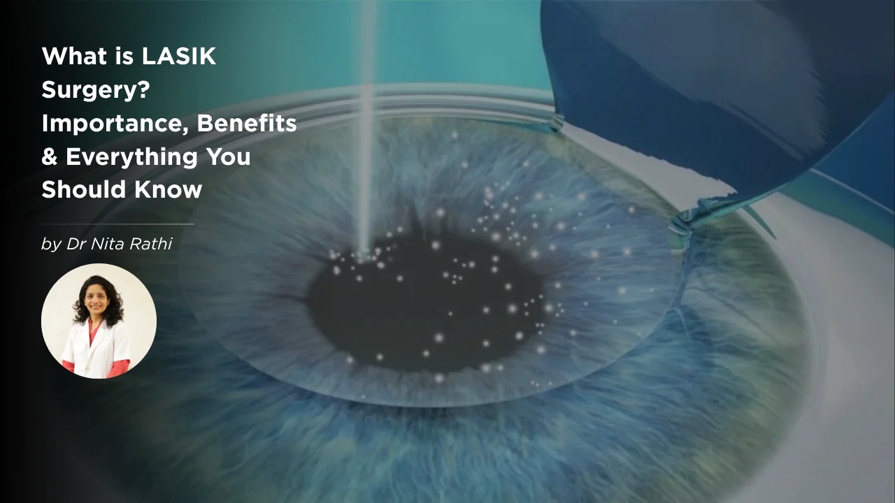 best lasik surgery in nagpur