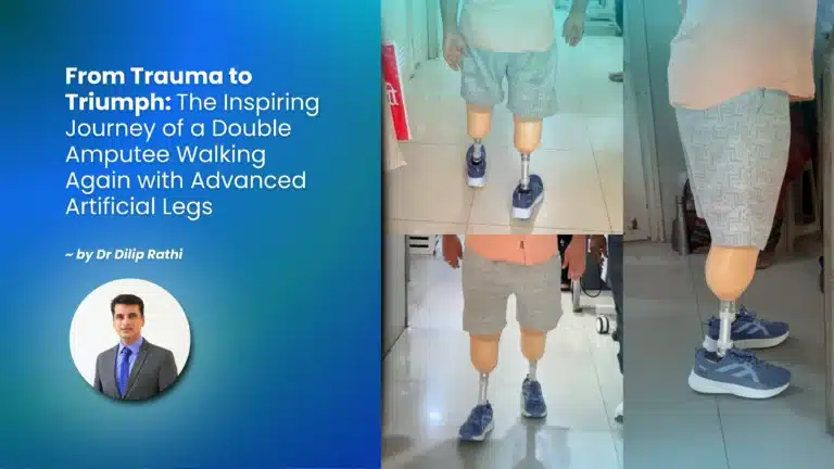 From Trauma to Triumph: The Inspiring Journey of a Double Amputee Walking Again with Advanced Artificial Legs