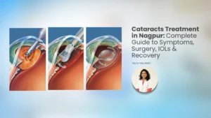 Cataracts treatment and cataract surgery for clearer vision in Nagpur