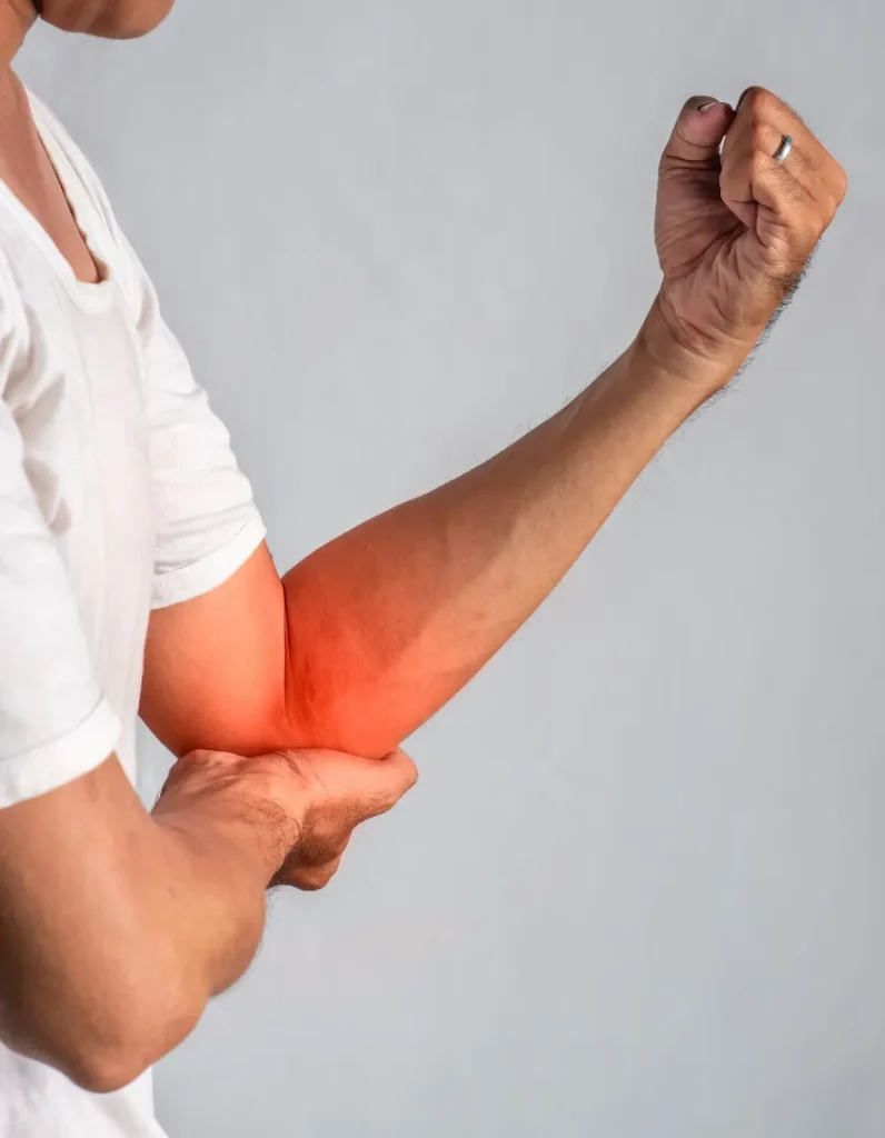 Elbow joint anatomy showing bones, muscles and ligaments
