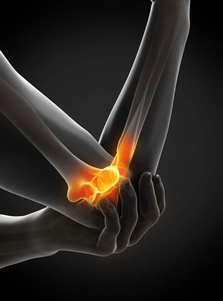 Elbow joint anatomy showing the humerus, radius and ulna