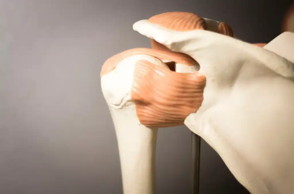 Meniscus: Knee Meniscus Injury Illustration