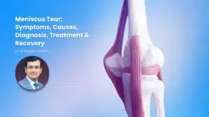Meniscus tear symptoms, causes, diagnosis, treatment and recovery