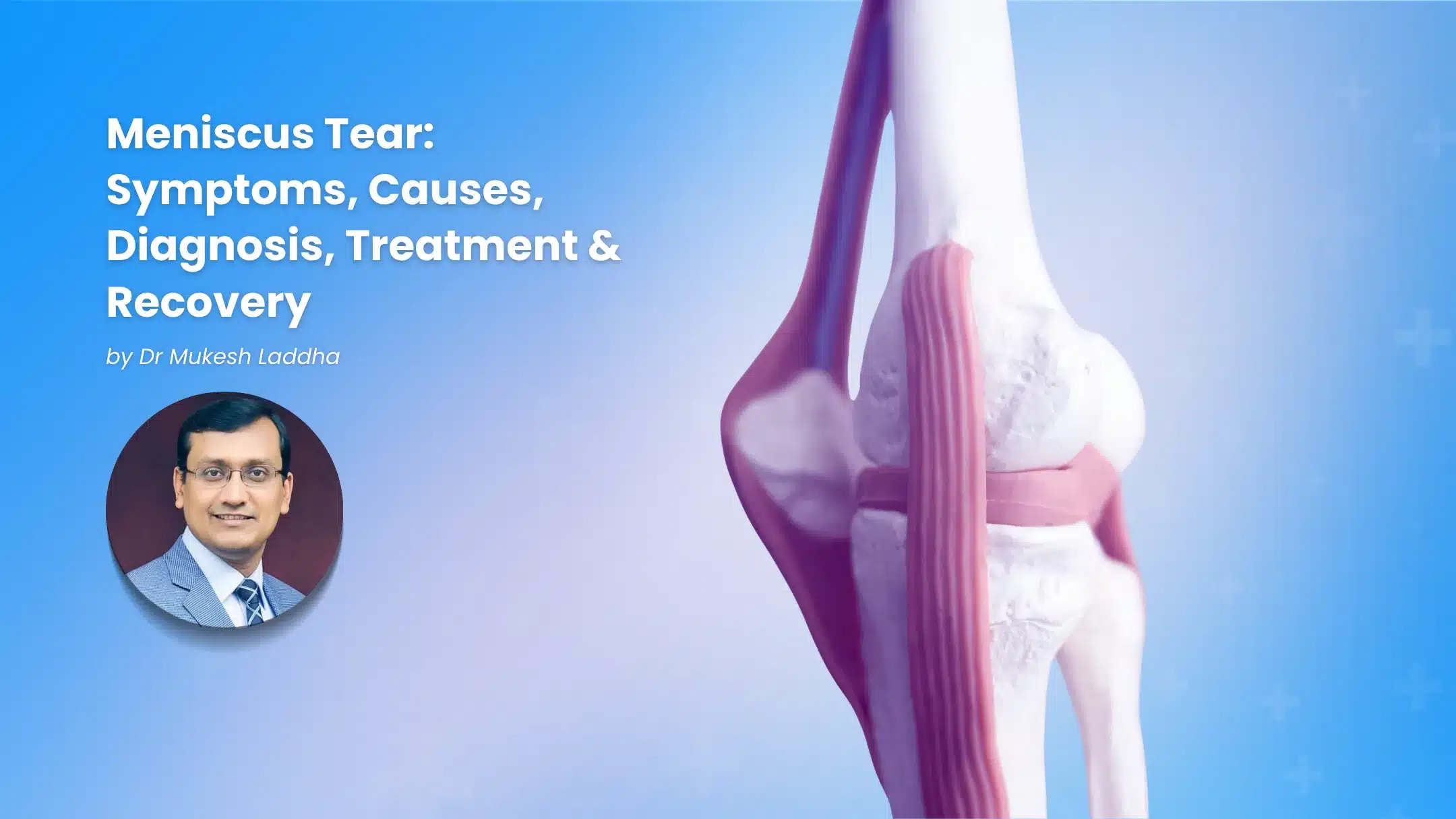 Meniscus tear symptoms, causes, diagnosis, treatment and recovery